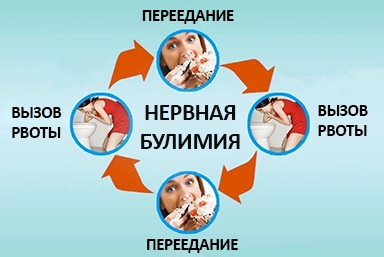 Лечение булимии в Суровикино